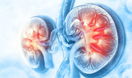 Síndrome de desgaste Proteico – Calórico en el Paciente Renal